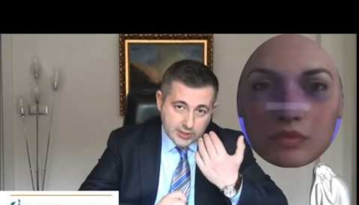 Burun Estetiği Rinoplasti Sonrası İyileşme Nasıldır? - Op. Dr. Aret Çerçi Özkan