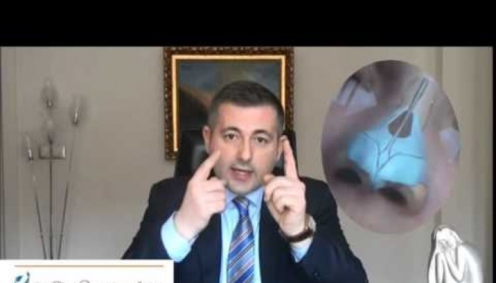Burun Estetiği Rinoplasti Nasıl Yapılır? - Op. Dr. Aret Çerçi Özkan